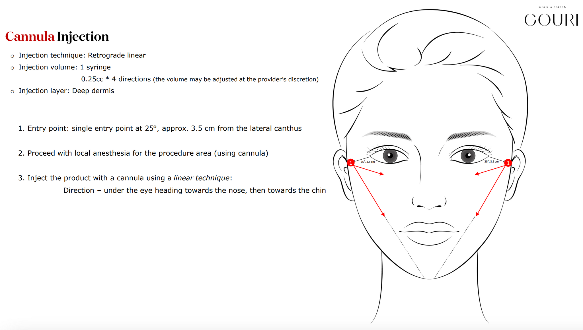 GOURI - Flüssiger PCL-Kollagenstimulator.